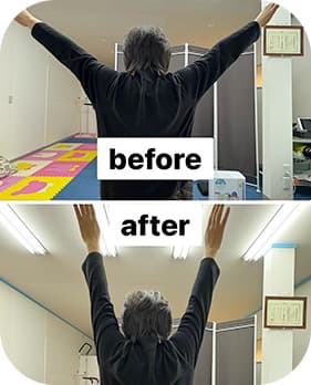 before after